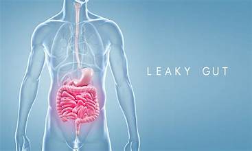 Leaky Gut and Supplements that can HELP!